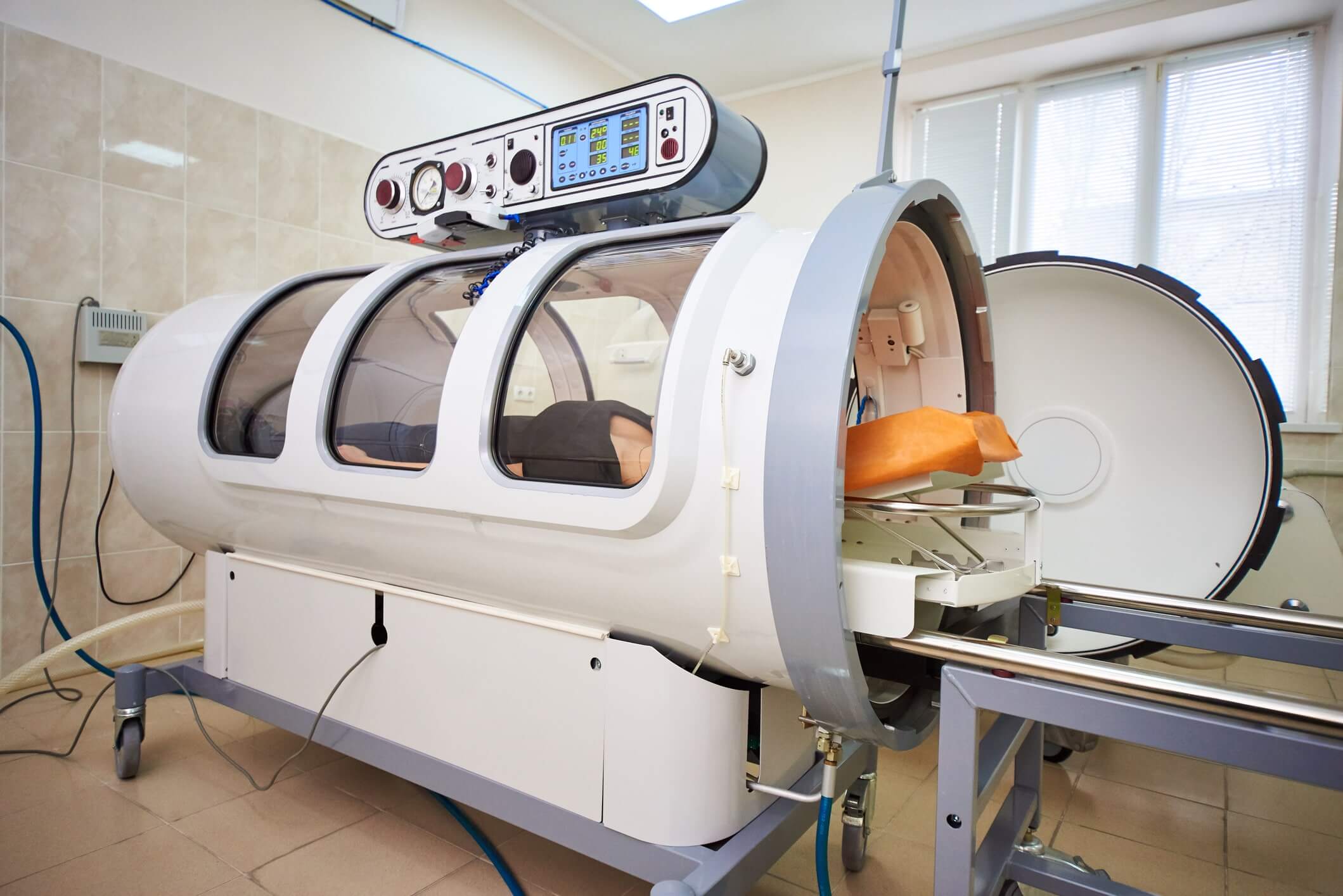 Los Angeles Hyperbaric Chamber Therapy